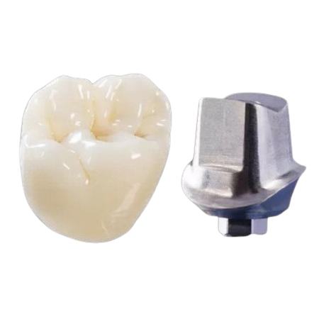 Full Strength Zirconia Cement Retained Crown