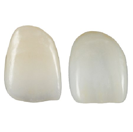 HT Multi-Layer Anterior Zirconia Crown, Bridge and Onlays