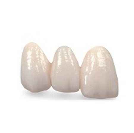 HT Multi-Layer Anterior Zirconia Crown, Bridge and Onlays