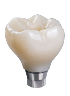 Full Strength Zirconia Screw Retained Crown