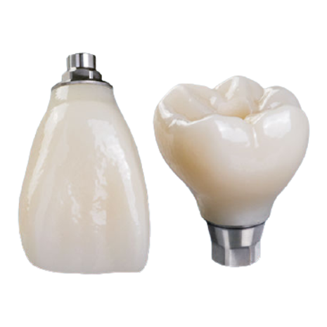 Implants