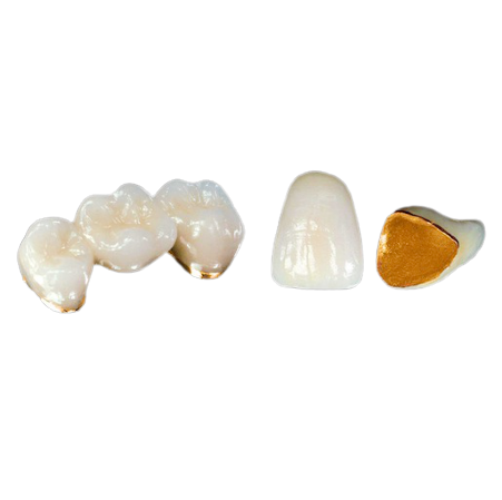 PFM - Yellow Gold 90