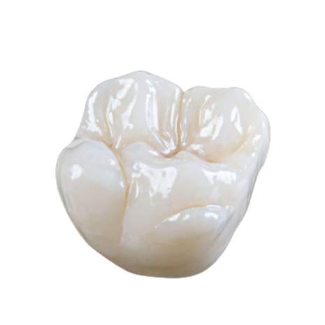 Porcelain Layered to Zirconia (PFZ) Crown and Bridge