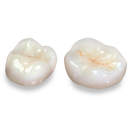 Porcelain Layered to Zirconia (PFZ) Crown and Bridge