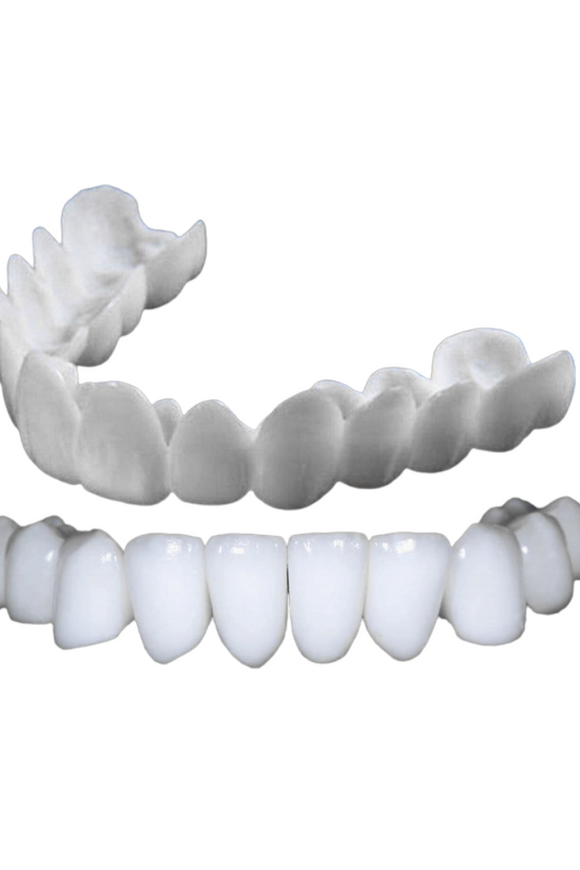 Snap On Veneers