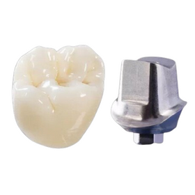 Full Strength Zirconia Cement Retained Crown
