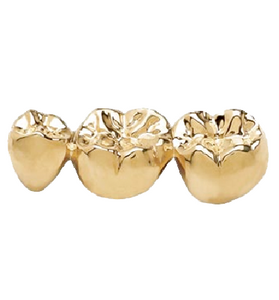 Full Cast - Yellow Gold 2 Noble