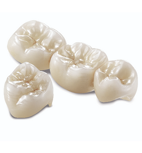 Full Strength Zirconia Crown and Bridge
