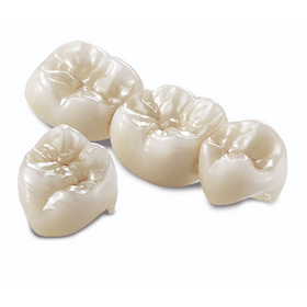 Full Strength Zirconia Crown and Bridge