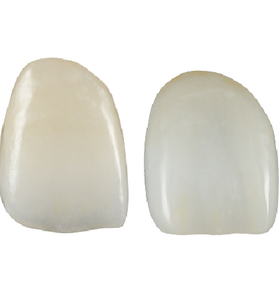 HT Multi-Layer Anterior Zirconia Crown, Bridge and Onlays