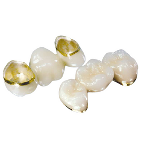 PFM - Yellow Gold 90