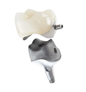 PFM Non Precious Cement Retained Crown