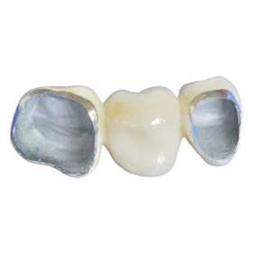 PFM - White Gold 40 High Noble