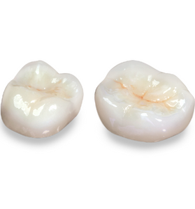 Porcelain Layered to Zirconia (PFZ) Crown and Bridge