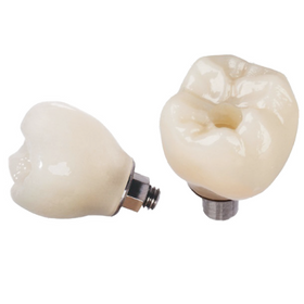 Porcelain to Zirconia (PFZ) Screw Retained Crown