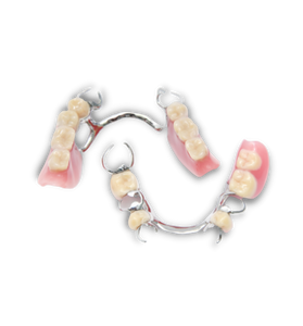 Cast Partial Dentures