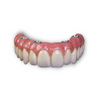 Full Arch Solid Zirconia Complete