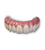 Full Arch Solid Zirconia Complete