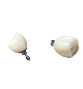 PFM Non Precious Screw Retained Crown with All Plastic UCLA