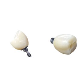 PFM Non Precious Screw Retained Crown with All Plastic UCLA